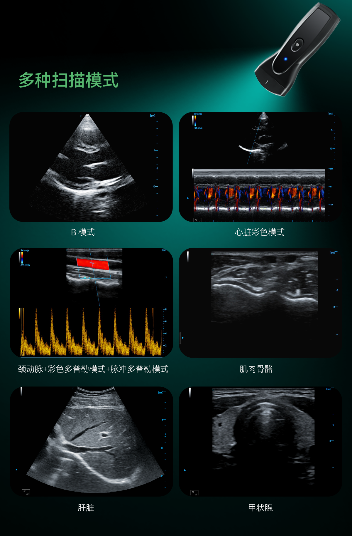 单头掌超中文详情0626_05