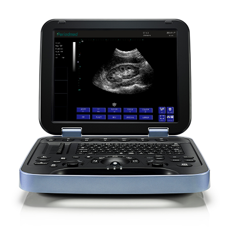 PU-DL152A全数字便携式超声诊断系统