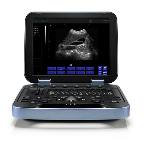 PU-DL153A全数字便携式超声诊断系统